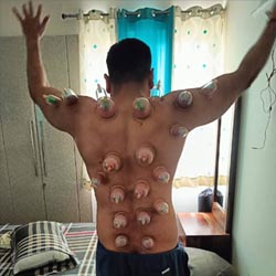 Chauhan Physio & Neuro Rehabilition Clinic